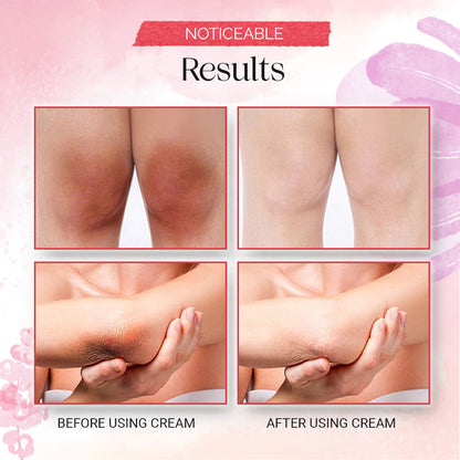 Women Pink Skin Pigmentation Removing Cream