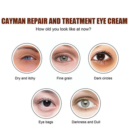 【Flash Sale】Eyliss™ Crocodile Oil Anti-Aging Eye Cream