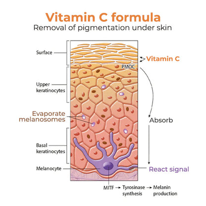 FreckleAway™ Vitamin C Freckle Removal Gel
